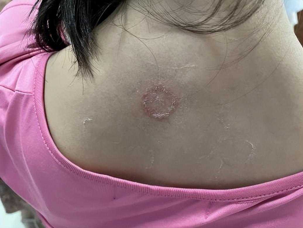 尤卓爾軟膏價格大解密，重磅揭秘真實價格??