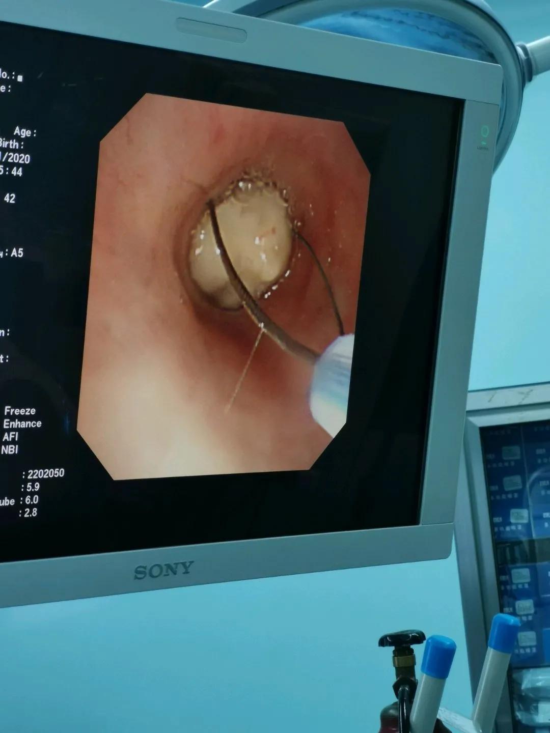 電子鼻咽喉鏡價(jià)格的市場(chǎng)定位分析，多元因素下的市場(chǎng)趨勢(shì)探討