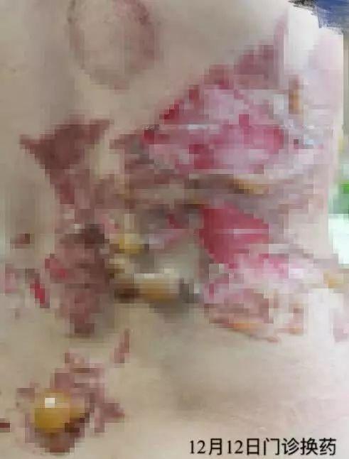 小巷特色養(yǎng)生館，最新拔罐圖片分享