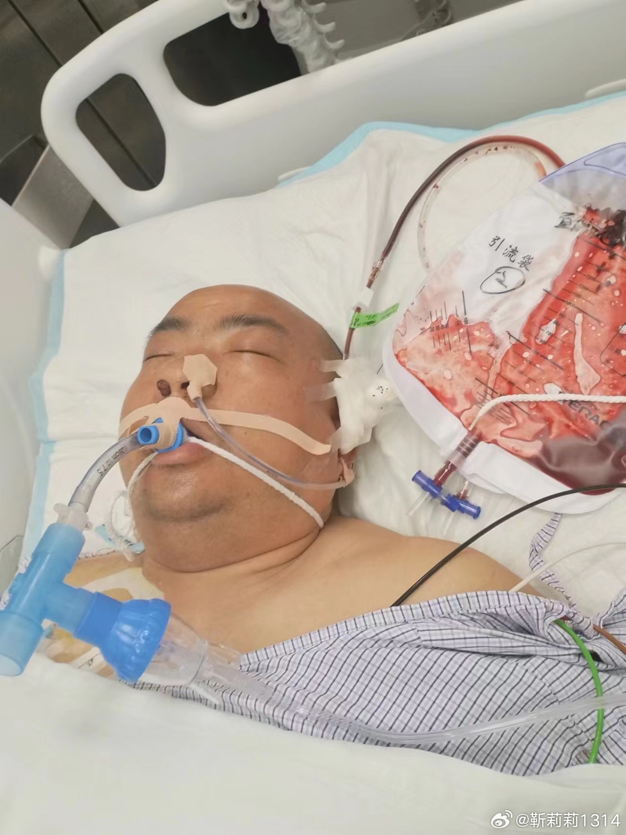 馮現(xiàn)學(xué)腦出血最新消息及應(yīng)對(duì)幫助指南(初學(xué)者與進(jìn)階用戶(hù)參考)